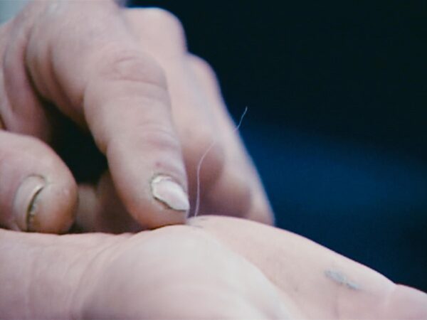 Close up of a light-skinned hand with dirty nails pointed to a thread coming out of a body part