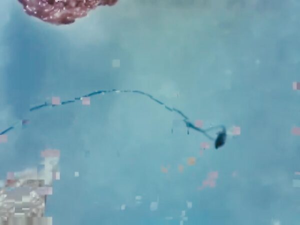 A black string-like object cuts through a mostly light blue field of color