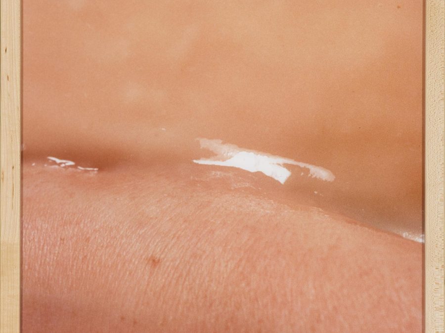 A framed picture of a shimmery liquid-like line in the middle of the crease of skin